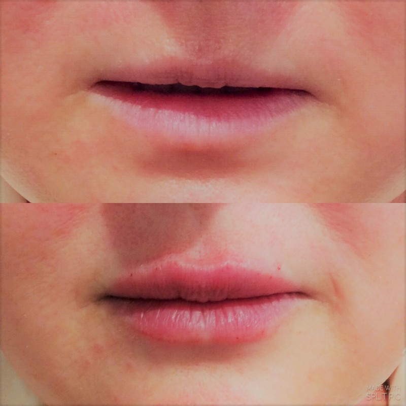lip-versa-7_26_18-NAPA-filter lip-versa-7_26_18-NAPA-filter